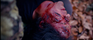 A person lying down with deep cuts on their face
